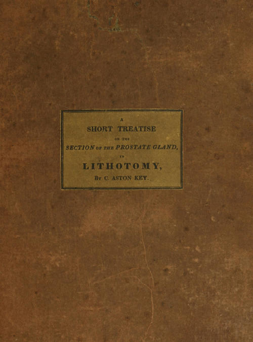 A Short Treatise on the Section of the Prostate Gland in Lithotomy&#10;With an Explanation of a Safe and Easy Method of Conducting the Operation on the Principles of Cheselden