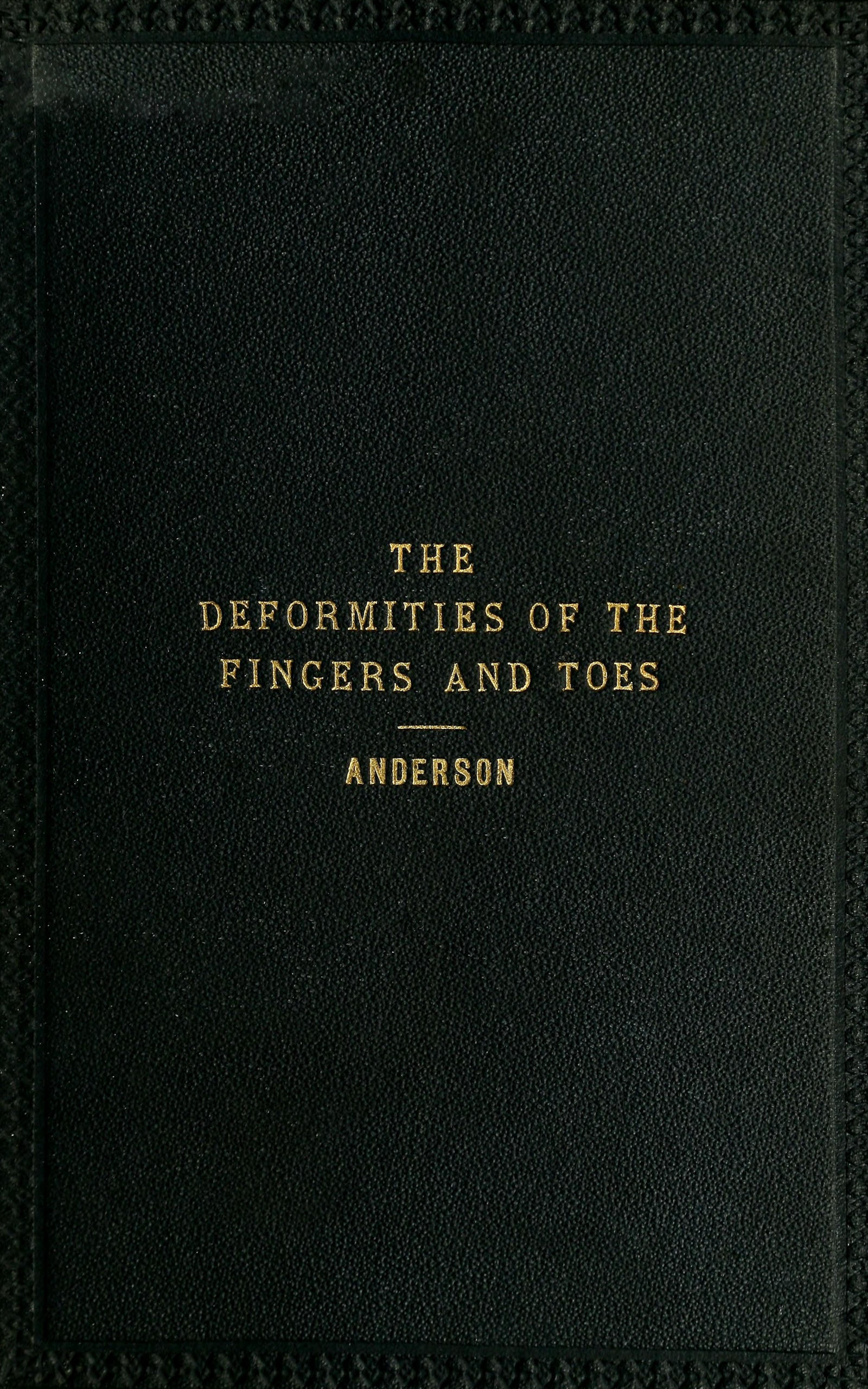 The deformities of the fingers and toes