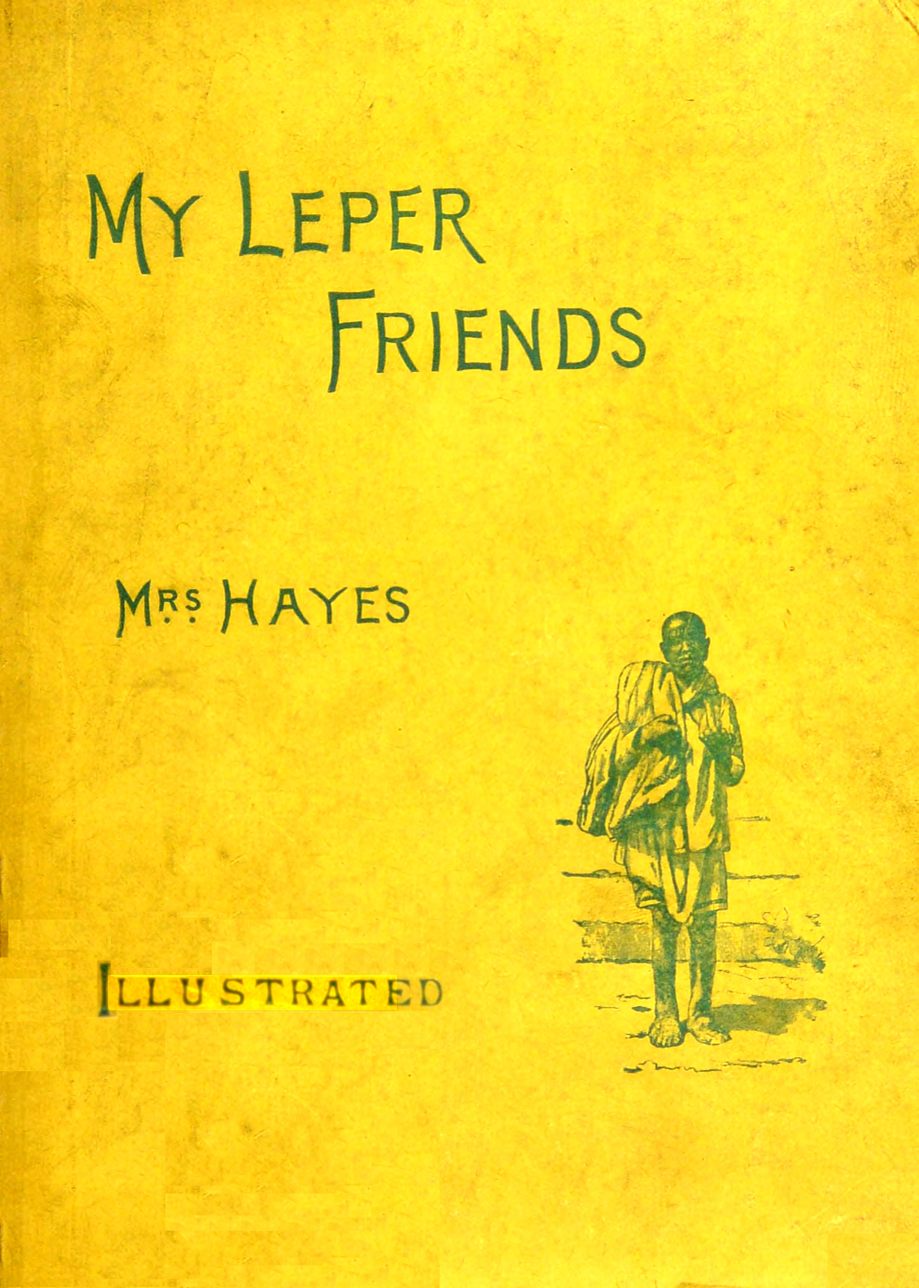 My leper friends